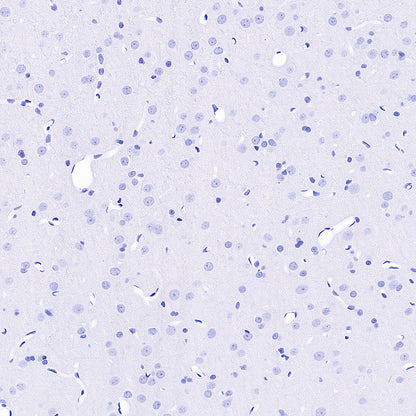 groEL Recombinant Rabbit mAb (S-4634-25)