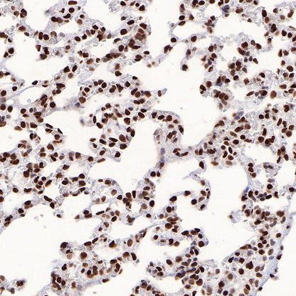 HMGB1 Recombinant Rabbit mAb (S-R305)