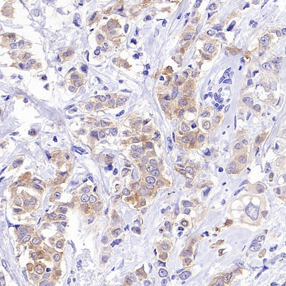 INPP4B Recombinant Rabbit mAb (S-3210-62)