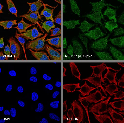 NF-κB2 p100/p52 Recombinant Rabbit mAb (S-2502-70)