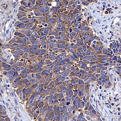 eIF3B Recombinant Rabbit mAb (S-816-8)
