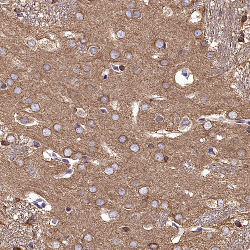 α/β-Tubulin Antibody Rabbit Polyclonal Antibody