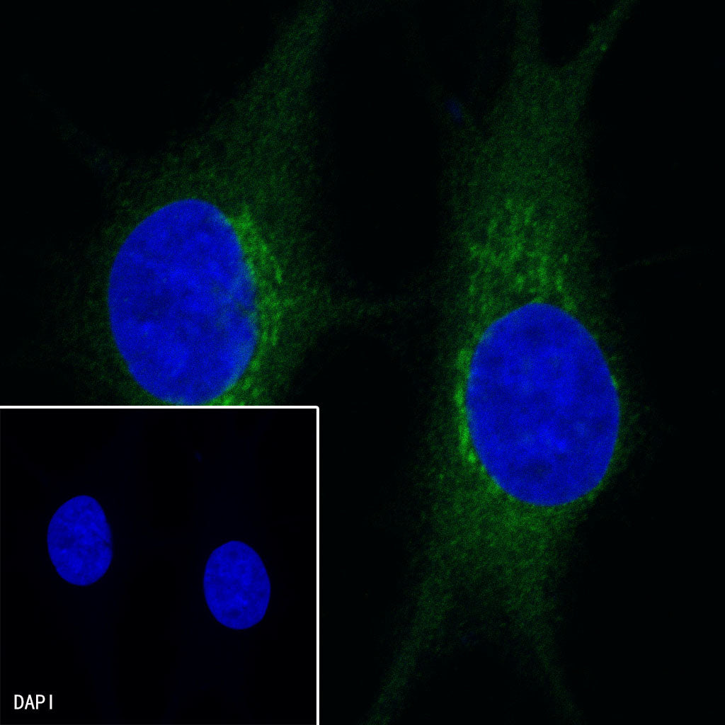 GPNMB Recombinant Rabbit mAb (S-491-6)