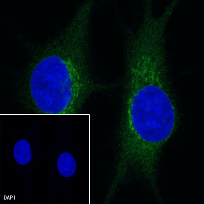 GPNMB Recombinant Rabbit mAb (S-491-6)