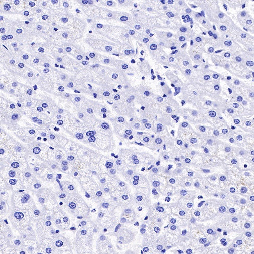 α/β-Synuclein Recombinant Rabbit mAb (S-309-72)