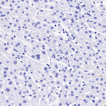 α/β-Synuclein Recombinant Rabbit mAb (S-309-72)