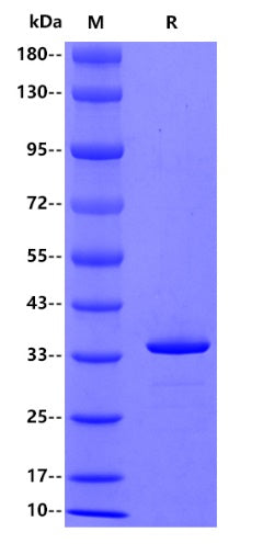 Human NFAT1, His tag