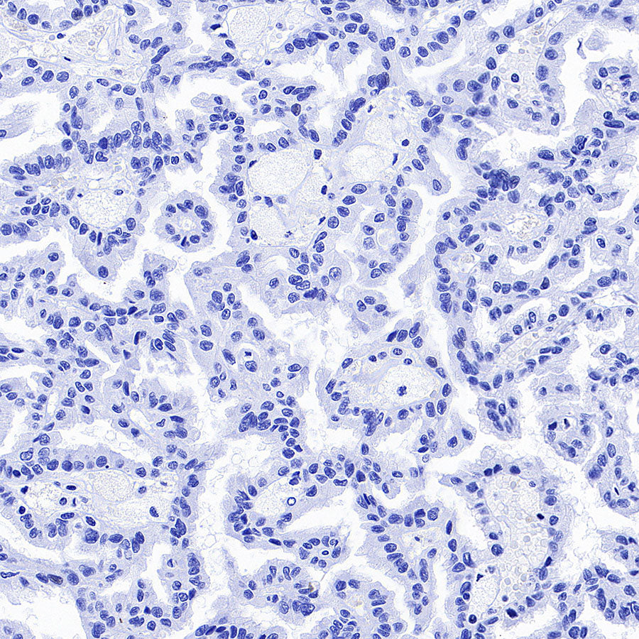 BSND Recombinant Rabbit mAb (S-3815-70)