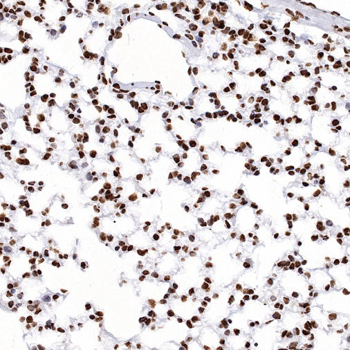hnRNPK Recombinant Rabbit mAb (S-1645-45)