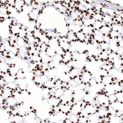 hnRNPK Recombinant Rabbit mAb (S-1645-45)