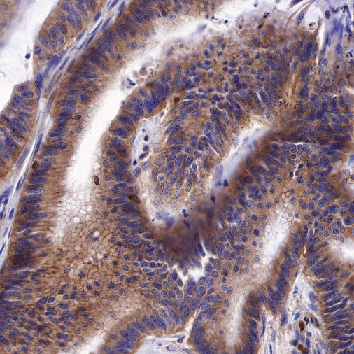 PI3 Kinase p85α Recombinant Rabbit mAb (S-328-24)