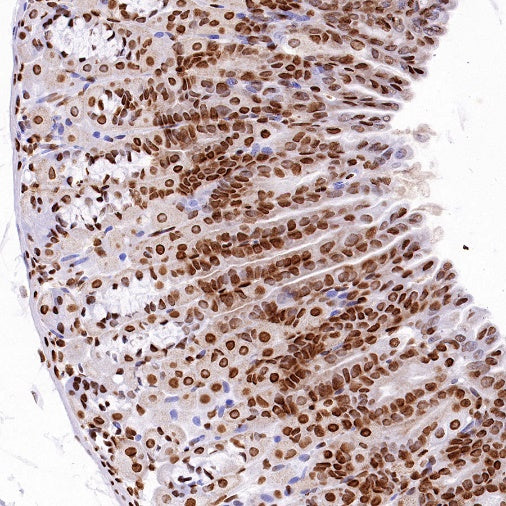 HDAC2 Recombinant Rabbit mAb (S-1474-27)