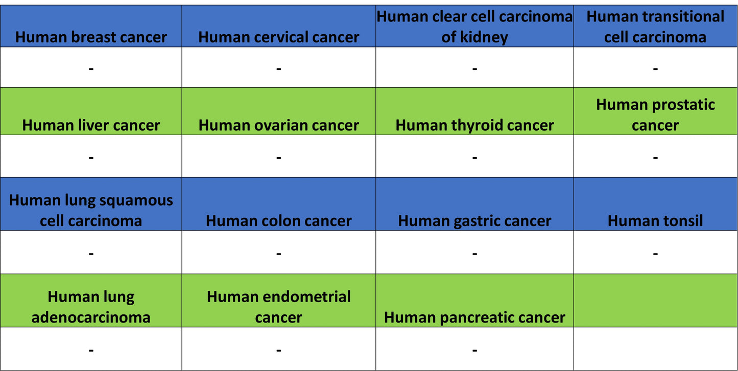CREM Recombinant Rabbit mAb (S-3375-19)
