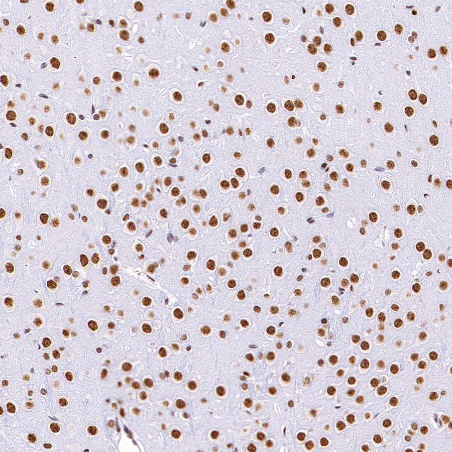 HNRNPL Rabbit Polyclonal Antibody