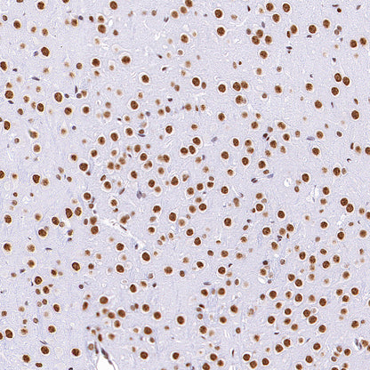 HNRNPL Rabbit Polyclonal Antibody