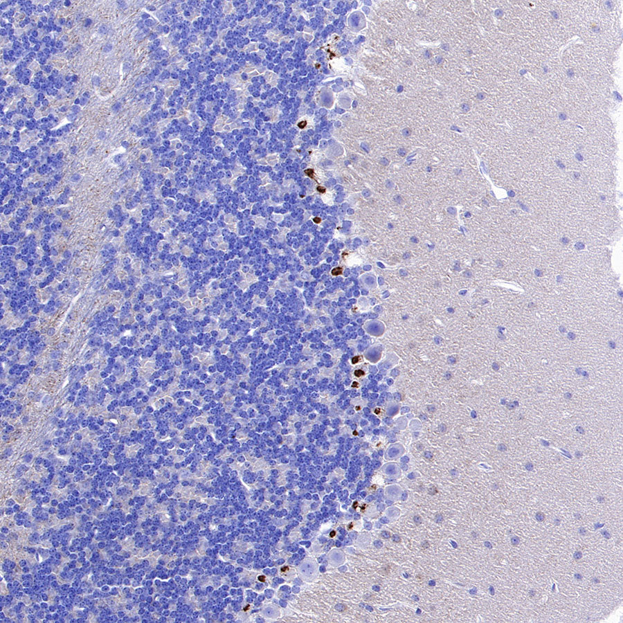 KCNA2 Recombinant Rabbit mAb (S-3939-53)