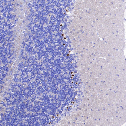 KCNA2 Recombinant Rabbit mAb (S-3939-53)