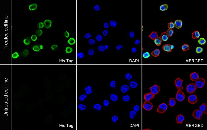 His tag Recombinant Rabbit mAb (S-1398-151)