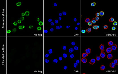 His tag Recombinant Rabbit mAb (S-1398-151)