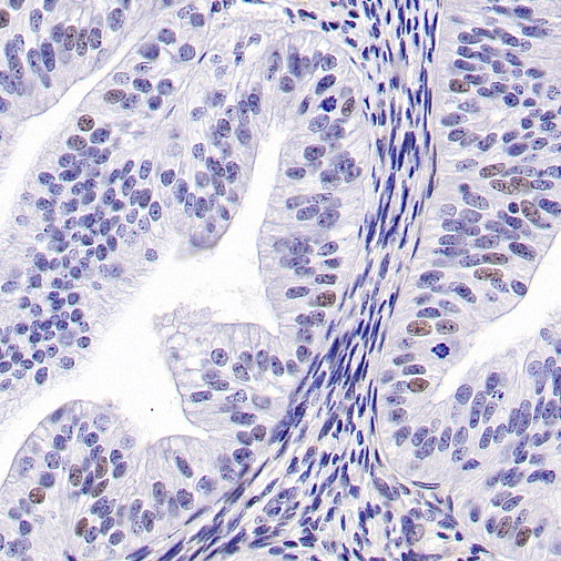 CDK6 Recombinant Rabbit mAb (S-1312-23)