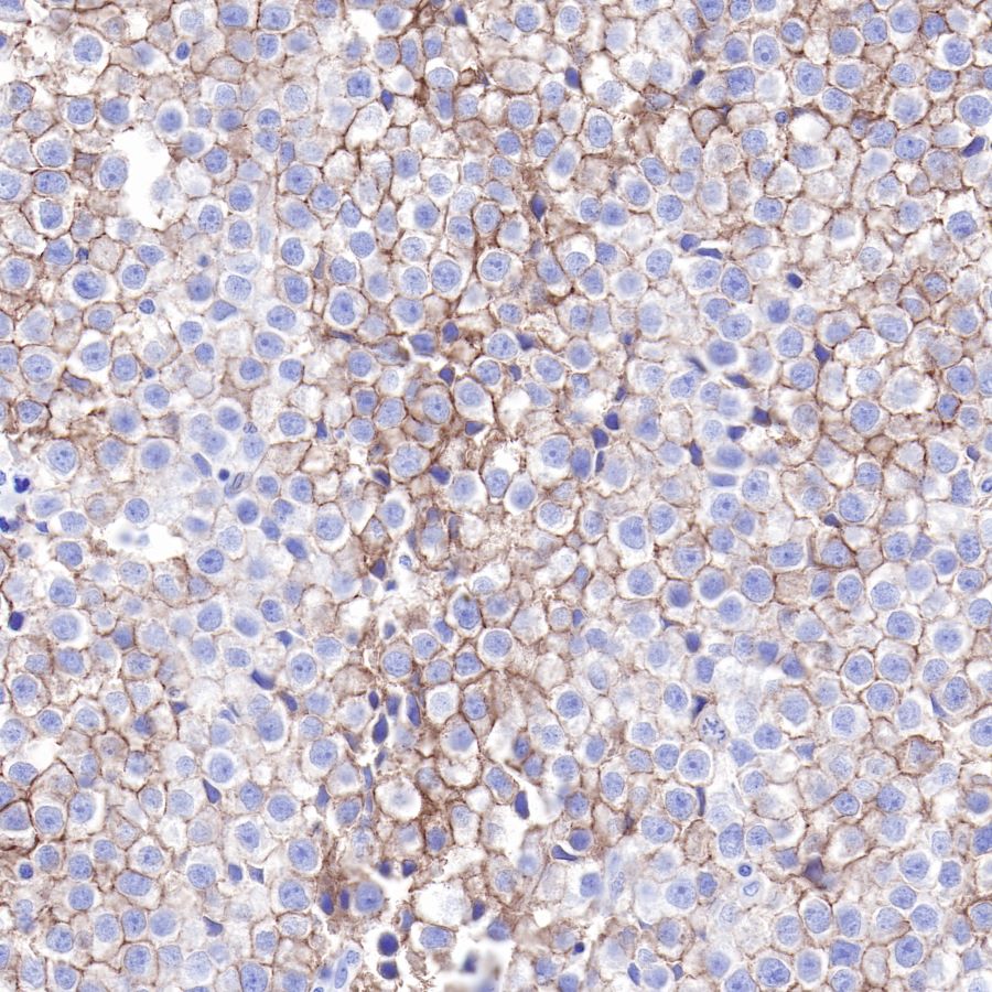 S-RMab® CD117 Recombinant Rabbit mAb,PBS Only (SDT-125-51)