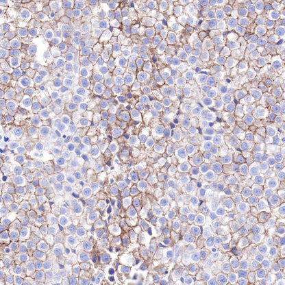 S-RMab® CD117 Recombinant Rabbit mAb,PBS Only (SDT-125-51)