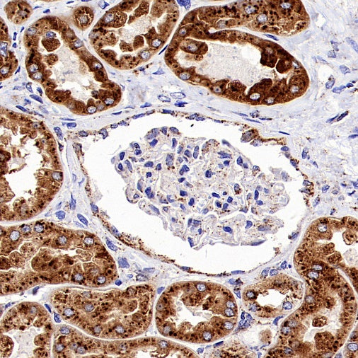 beta Galactosidase/GLB1 Recombinant Rabbit mAb (S-2295-7)