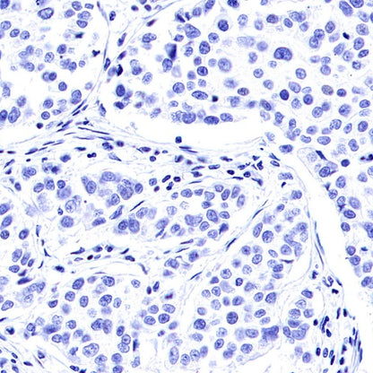 SNAP25 Recombinant Rabbit mAb (S-1828-67)