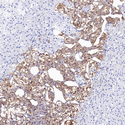 Tyrosine Hydroxylase Recombinant Rabbit mAb (S-1001-26)