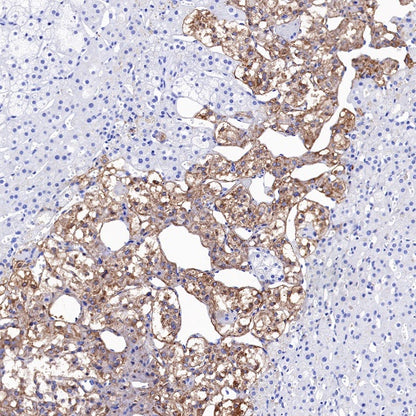 Tyrosine Hydroxylase Recombinant Rabbit mAb (S-1001-26)