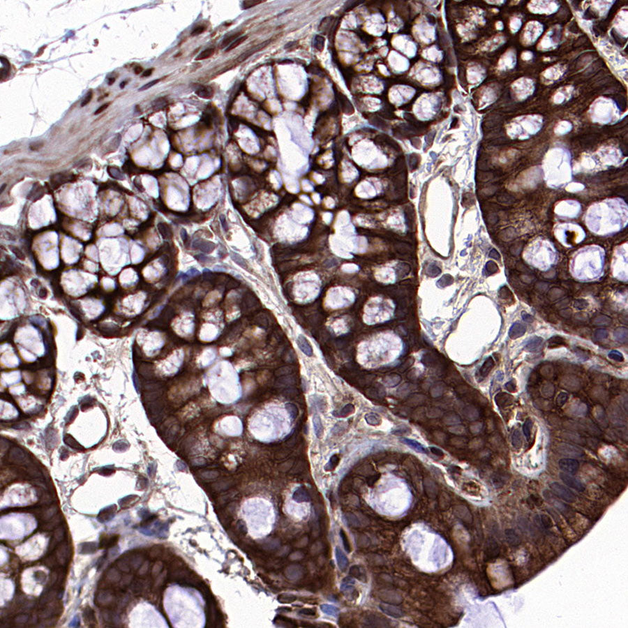 HSP90 Recombinant Rabbit mAb (S-5412)