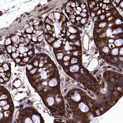 HSP90 Recombinant Rabbit mAb (S-5412)