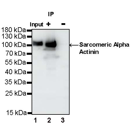 Sarcomeric Alpha Actinin Recombinant Rabbit mAb (S-1652-40)