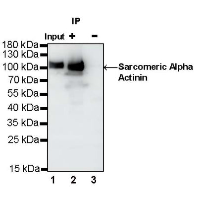 Sarcomeric Alpha Actinin Recombinant Rabbit mAb (S-1652-40)