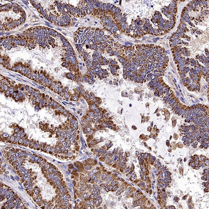 GRP75 Rabbit Polyclonal Antibody