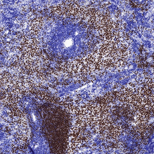 S-RMab® PAX5 Recombinant Rabbit mAb (SDT-R202)