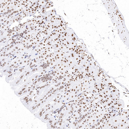 Histone H3 (mono methyl K79) Recombinant Rabbit mAb (S-R417)