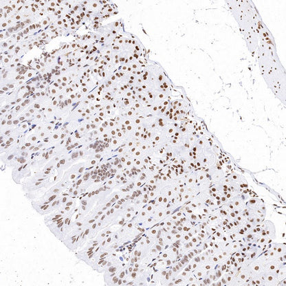 Histone H3 (mono methyl K79) Recombinant Rabbit mAb (S-R417)