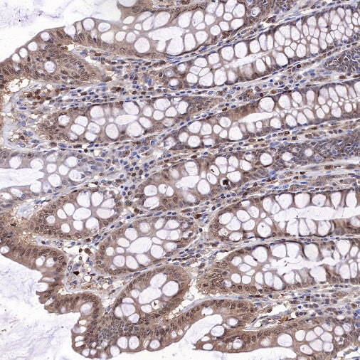 MEK3 Recombinant Rabbit mAb (S-835-23)