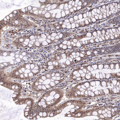 MEK3 Recombinant Rabbit mAb (S-835-23)