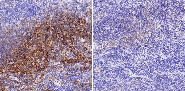 Phospho- Zap-70 (Tyr319)/Syk (Tyr352) Recombinant Rabbit mAb (S-1252-12)