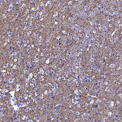 VGLUT2 Recombinant Rabbit mAb (S-4399-14)