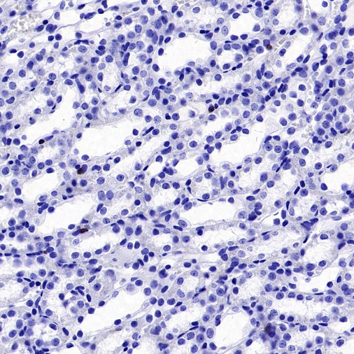 CD19 Recombinant Rabbit mAb (S-3357)