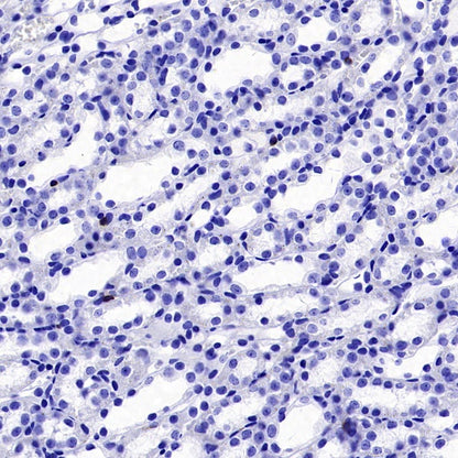 CD19 Recombinant Rabbit mAb (S-3357)