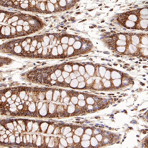 PPIF/Cyclophilin F Recombinant Rabbit mAb (S-2043-61)