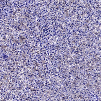 DHFR Recombinant Rabbit mAb (S-2542-9)