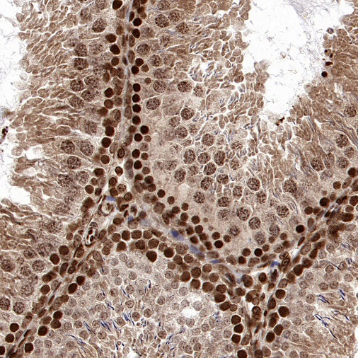 SMARCD1 Rabbit Polyclonal Antibody