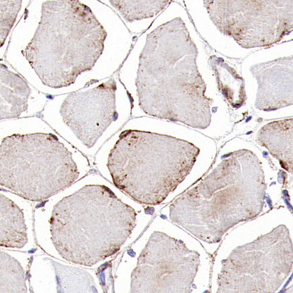 GLUT4 Recombinant Rabbit mAb (S-584-50)