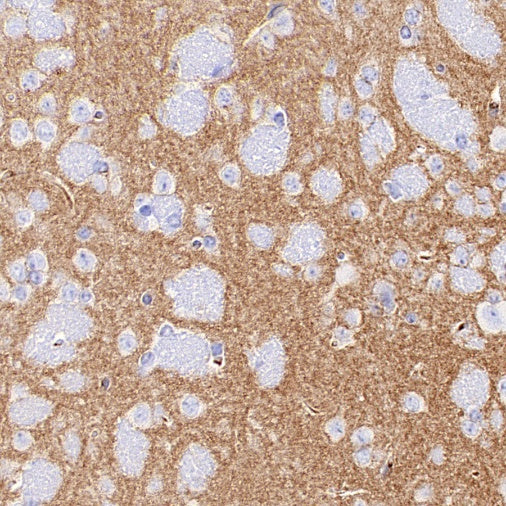 LOX Recombinant Rabbit mAb (S-1647-49)