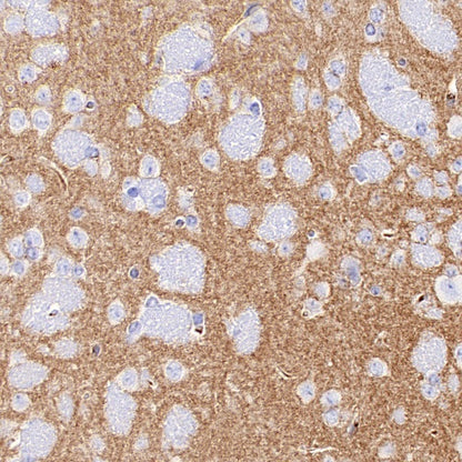 LOX Recombinant Rabbit mAb (S-1647-49)